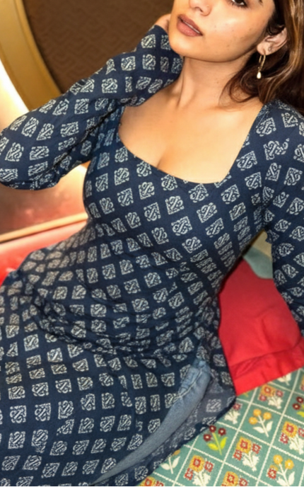 It fit so well. Quality 10 on 10 🦋
